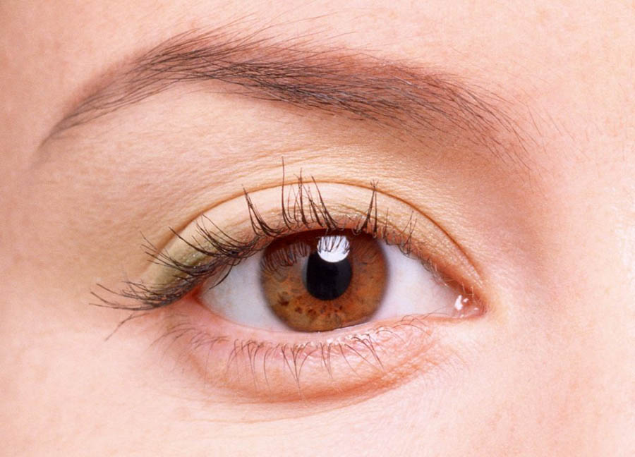 Bọng mắt mạn tính cũng là một trong những triệu chứng liên quan đến bệnh thận
