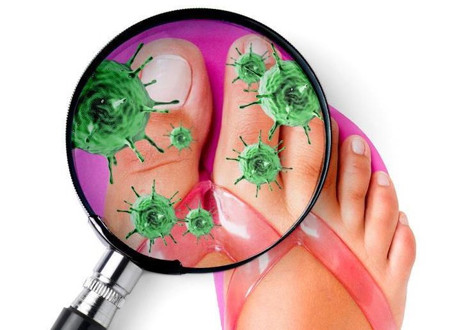 Dép xỏ ngón có thể biến đôi chân thành ổ vi khuẩn